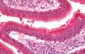 CS / Citrate Synthase Antibody